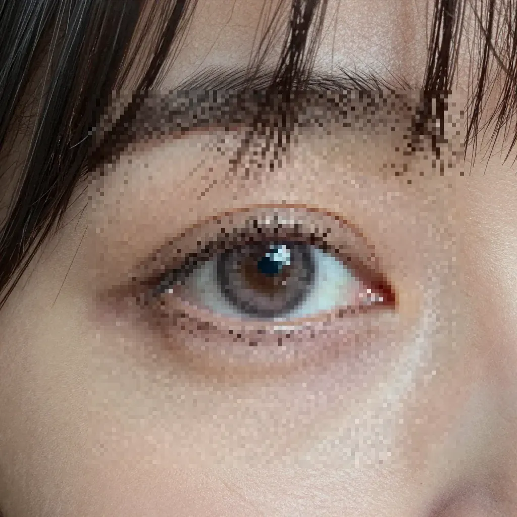 heterochromia s2